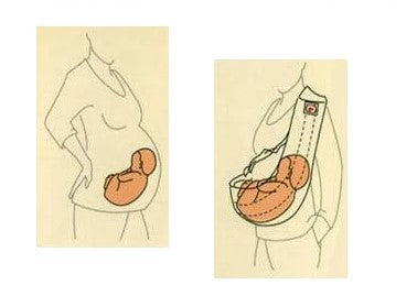 Porte-bébé emmaillotage™